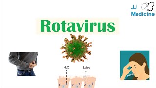 Rotavirus  Risk Factors Pathophysiology Symptoms Diagnosis Treatment [upl. by Lupita]