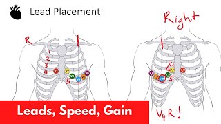 Learning to Read an ECG 8 simple steps [upl. by Samala]