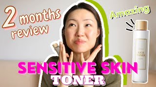 IM From Rice Toner Before And After  2 months Honest Review for Sensitive Acne Prone Skin [upl. by Ardried]