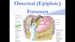 Omental Epiploic Foramen [upl. by Assi412]