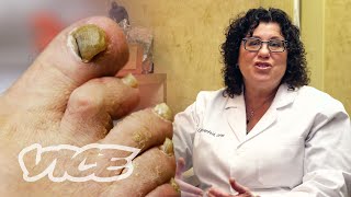 Meet a Toenail Fungus Expert [upl. by Llevrac]