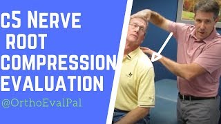 C5 Nerve Root Compression Evaluation [upl. by Aelahc]