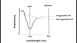 How does Pulse Oximetry work [upl. by Janella]