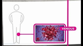 Venous Thrombosis Explained [upl. by Hulbert50]