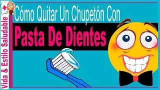 Cómo quitar un chupetón con Pasta De Dientes ✫ TRUCO que NO CONOCES FUNCIONA ❤ [upl. by Dreddy]