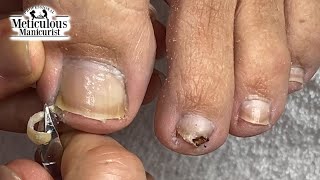 Mr Meticulous Deep Sidewall Cleaning Ingrown Prevention [upl. by Hayes]