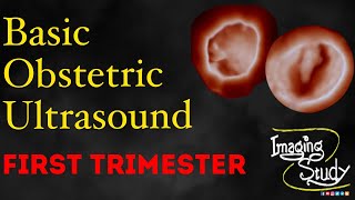 Basic Obstetric Ultrasound First Trimester Pregnancy [upl. by Gustafson]