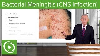 Bacterial Meningitis CNS Infection – Infectious Diseases  Lecturio [upl. by Narual]