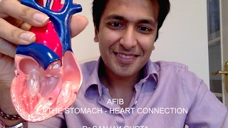 Afib The stomachheart connection [upl. by Eyla938]