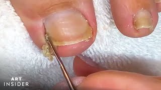 How Toenails Are Professionally Cleaned [upl. by Timofei105]