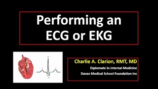 ECG Electrode Placement [upl. by Aneela]