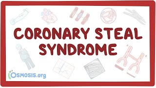 Prion Disease  GerstmannStraussler Scheinker GSS Syndrome by Julia Moreno [upl. by Andrade]