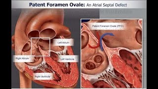 Fetal Circulation by L McCabe  OPENPediatrics [upl. by Coltson]