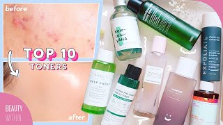 Best Toners for Acne Hyperpigmentation Large Pores Whiteheads amp Blackheads [upl. by Eidda]