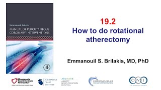 192 Rotational atherectomy Manual of PCI [upl. by Shipley]