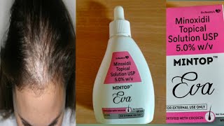 How to use mintop eva 50 solution for hair fall [upl. by Artened]