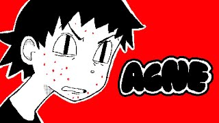 ACNE [upl. by Neelat]