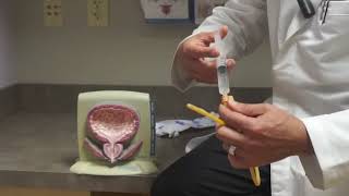 How a Bladder Catheter Works [upl. by Christopher924]