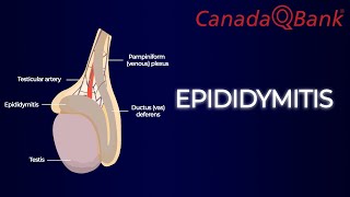 Epididymitis [upl. by Lacym936]