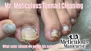 Shortn Sweet  Mr Meticulous Satisfying Impacted Toenail Cleaning [upl. by Siloum570]