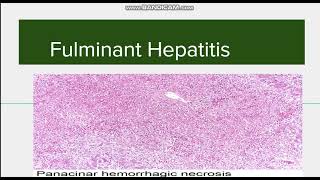 Fulminant Hepatitis Introduction Causes and Morphology [upl. by Dniren]