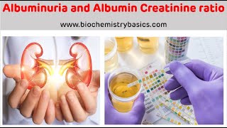 Albuminuria  Albumin Creatinine Ratio  Albumin In Urine [upl. by Coppola]