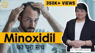 Minoxidil Hair Regrowth Results  Minoxidil Hair Regrowth Side Effects  Dr Nivedita Dadu [upl. by Mighell]